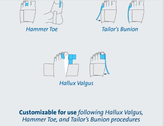 Toe Alignment Splint